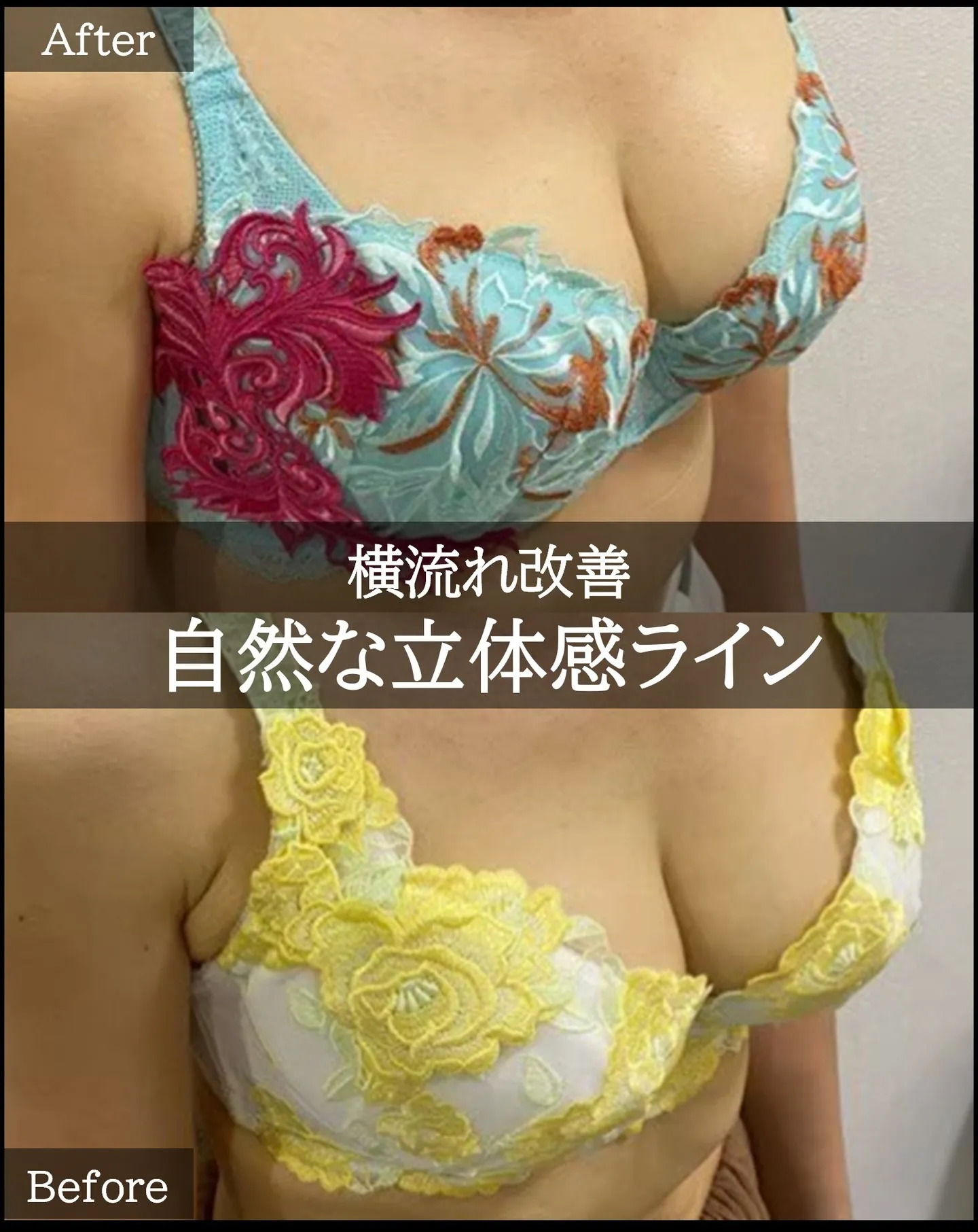 BeforeとAfter、中央ラインに注目✨