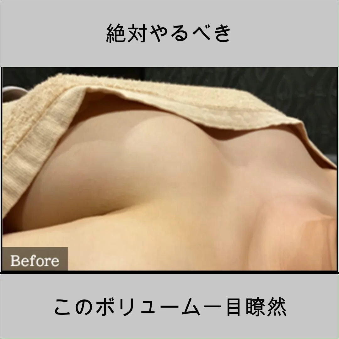BeforeとAfter、横から見ると一目瞭然✨