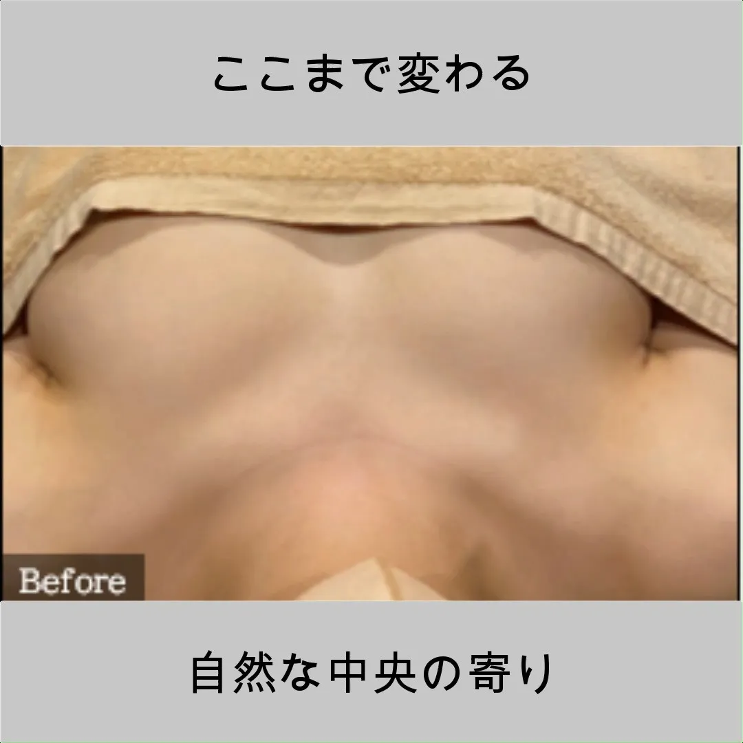 正面から見た印象、違い分かりますか？✨