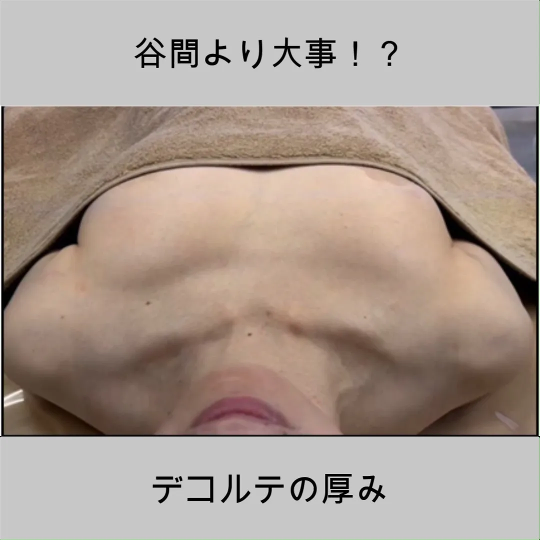 上部ボリューム、違い分かりますか？✨